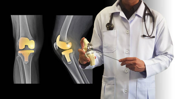 Best Knee Replacement Surgeon In Mulund-1